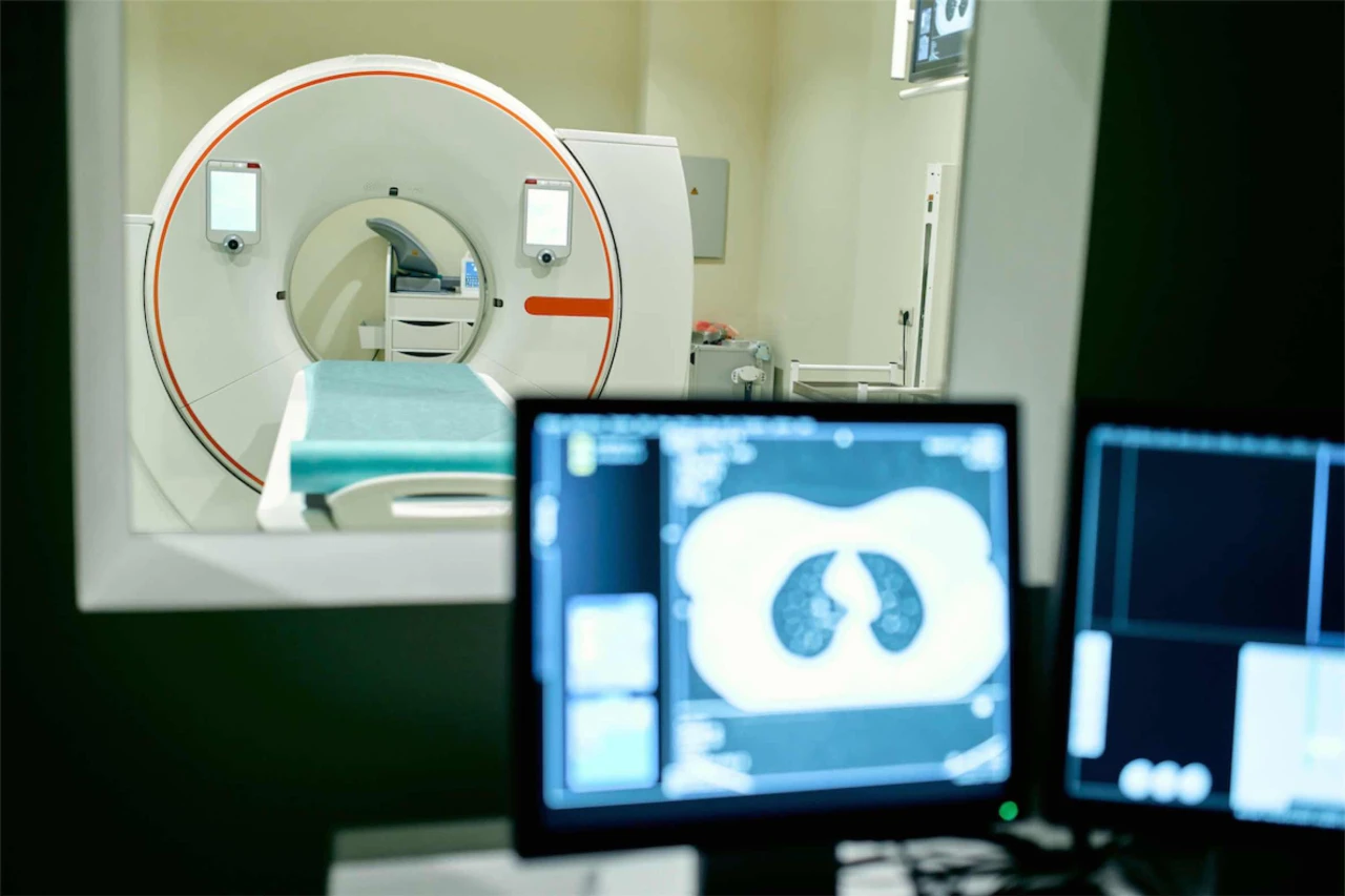 İnme riskini önceden tespit eden yerli ve milli yapay zeka algoritmasında hedef global pazar