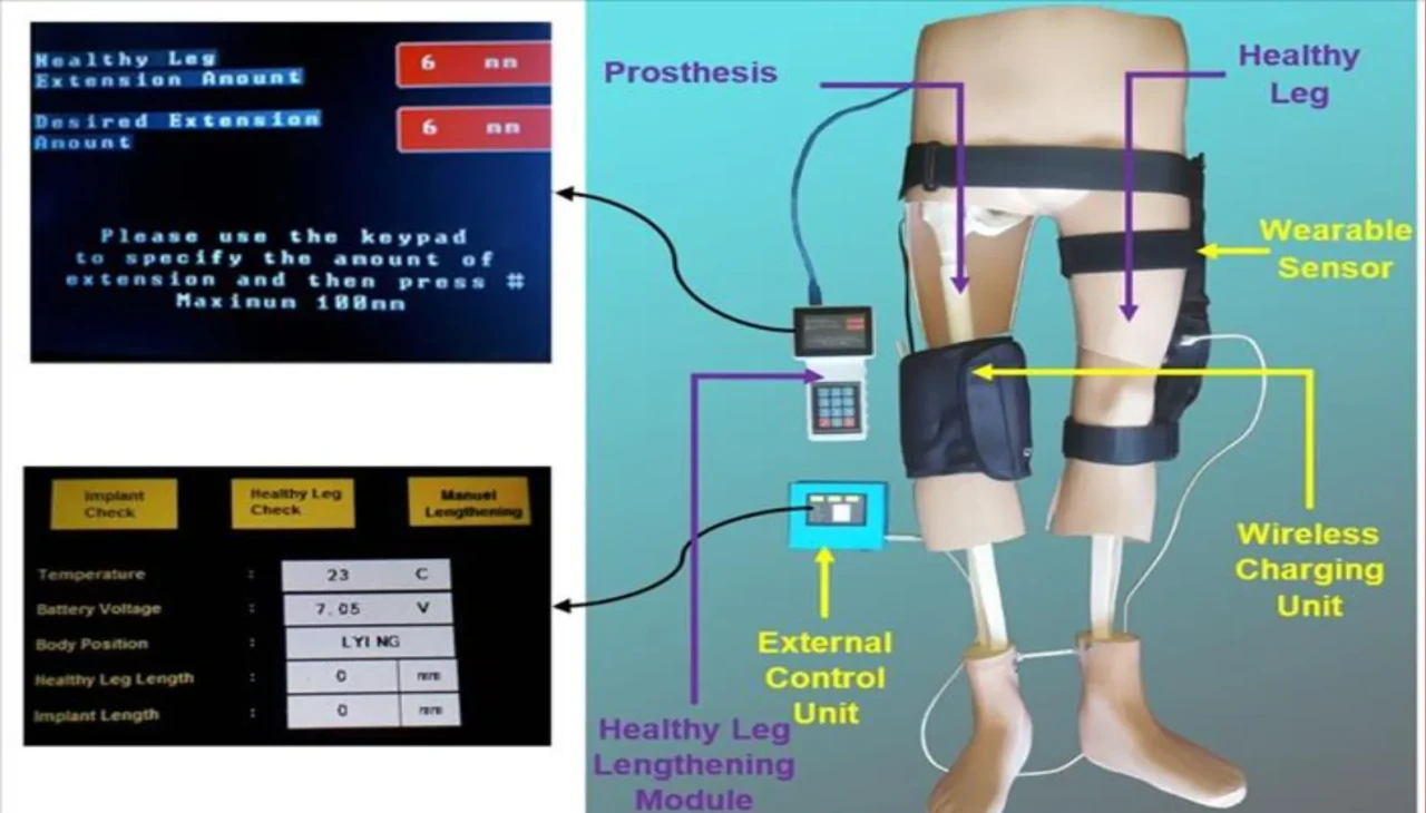 YTÜ’den çığır açan buluş: Otonom kontrollü ve uzatılabilir tümör protezi