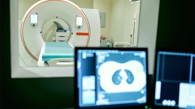 İnme riskini önceden tespit eden yerli ve milli yapay zeka algoritmasında hedef global pazar