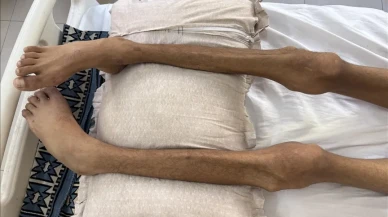 Gazze'de açlık ölümleri artıyor: Son 24 saatte 2 kişi daha hayatını kaybetti