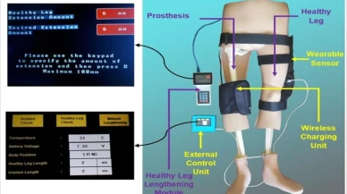YTÜ’den çığır açan buluş: Otonom kontrollü ve uzatılabilir tümör Protezi