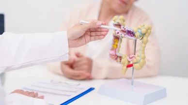 Güney Kore'den kolon kanserine umut veren keşif: NSMF geni tümörleri durduruyor