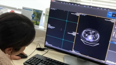 Yapay zeka ile kanserde %90 erken teşhis mümkün