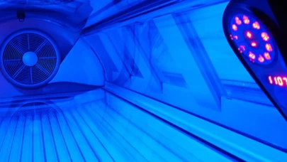 Solaryum DNA hasarı yaratıyor: Melanom riski 2,85 kat yükseliyor