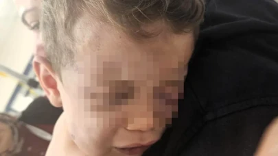 Denizli'de 2 Yaşındaki Bebek Darp Nedeniyle Hastaneye Yatırıldı; Sağlık Durumu Ciddiyetini Koruyor!