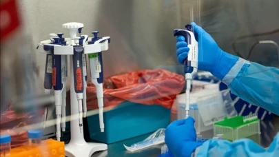 Gana'da Mpox kaynaklı ilk ölüm gerçekleşti