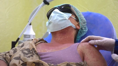 Van'da internetten alınan krem, 4 kişiyi hastanelik etti